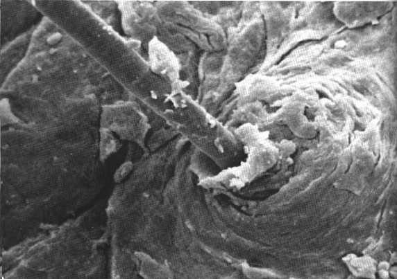 electron microscope images of human body
